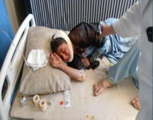 13 injured in two separate accidents in Logar