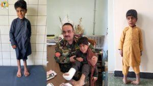 Specialists at Daoud Khan hospital perform complex muscular surgery