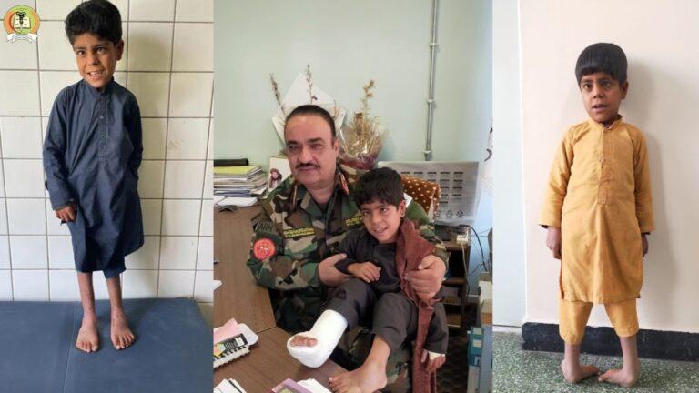 جراحی موفق یک بیماری پیچیدۀ عضلاتی در کمپلکس شهید سردار محمدداوود خان